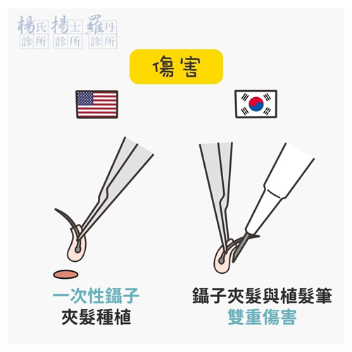 植髮 美式植髮,韓式植髮,植髮筆,楊氏羅丹